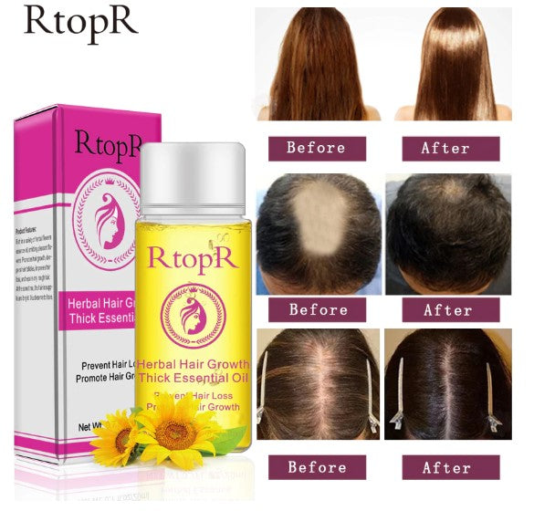 Herbal Hair Growth Anti Hair Loss Treatment 20ml Essential Oil