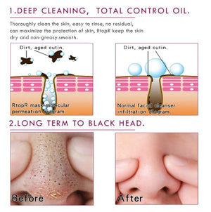 Mango Blackhead Remover Acne Treatment Nose Oil-control Mud Pore Strip Mask Whitening Cream Peel off Mask Nose Peel Skin Care